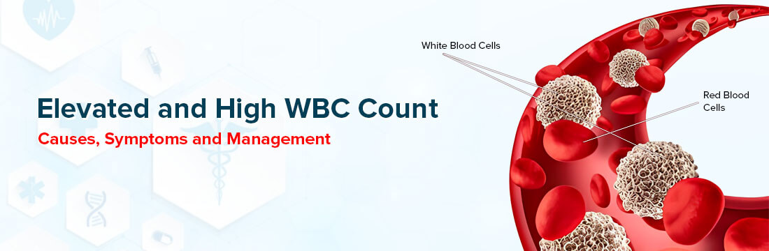 Know The Causes, Symptoms and Management of Elevated and High WBC Count